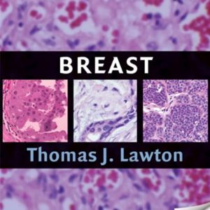 Breast (Hb 2009)